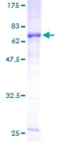 Human FST / Follistatin Protein (Recombinant GST)
