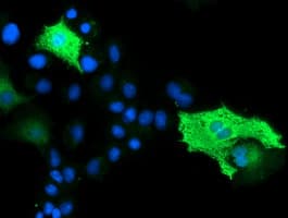 VMD2L3 / BEST3 Antibody (clone OTI3D7)