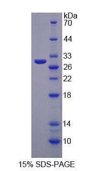 Human MPP3 Protein (Recombinant His-T7, N-terminus)
