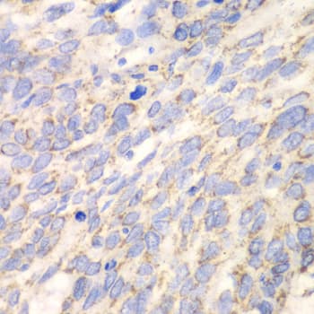 DLD / Diaphorase / E3 Antibody
