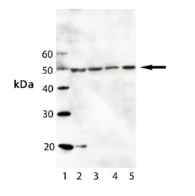 IFIH1 / MDA5 Antibody (clone 1B6)