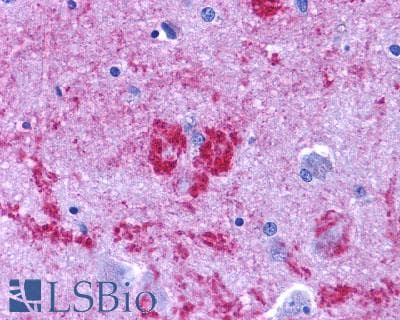 PathPlus™ EDNRB / Endothelin B Receptor Antibody (N-Terminus)