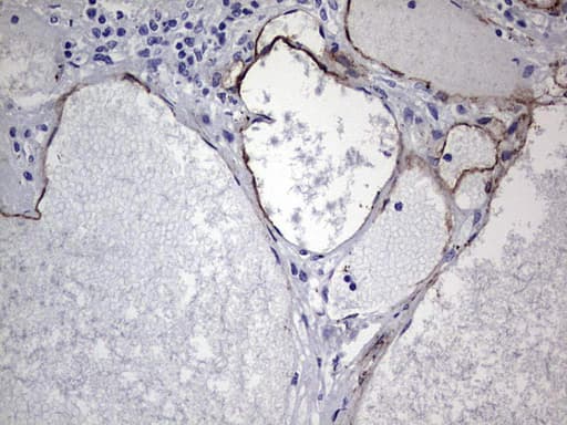 CDH4 / R Cadherin Antibody (aa170-428, clone OTI4F5, Carrier-free)