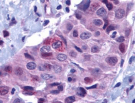 Polyclonal Rabbit anti-Human BBC3 / PUMA Antibody (IHC, WB)