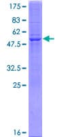 Human LDHAL6A Protein (Recombinant GST)