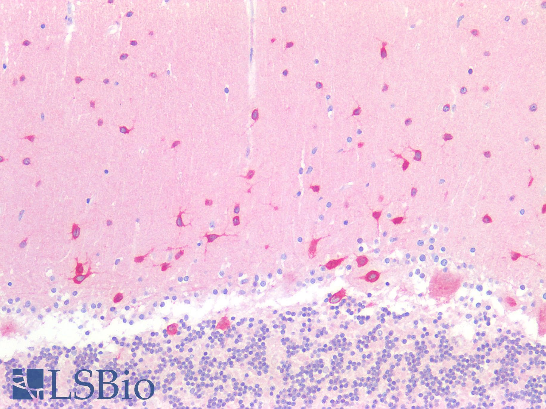 IHC-plus™ Syndapin I / PACSIN1 Antibody (aa8-38)
