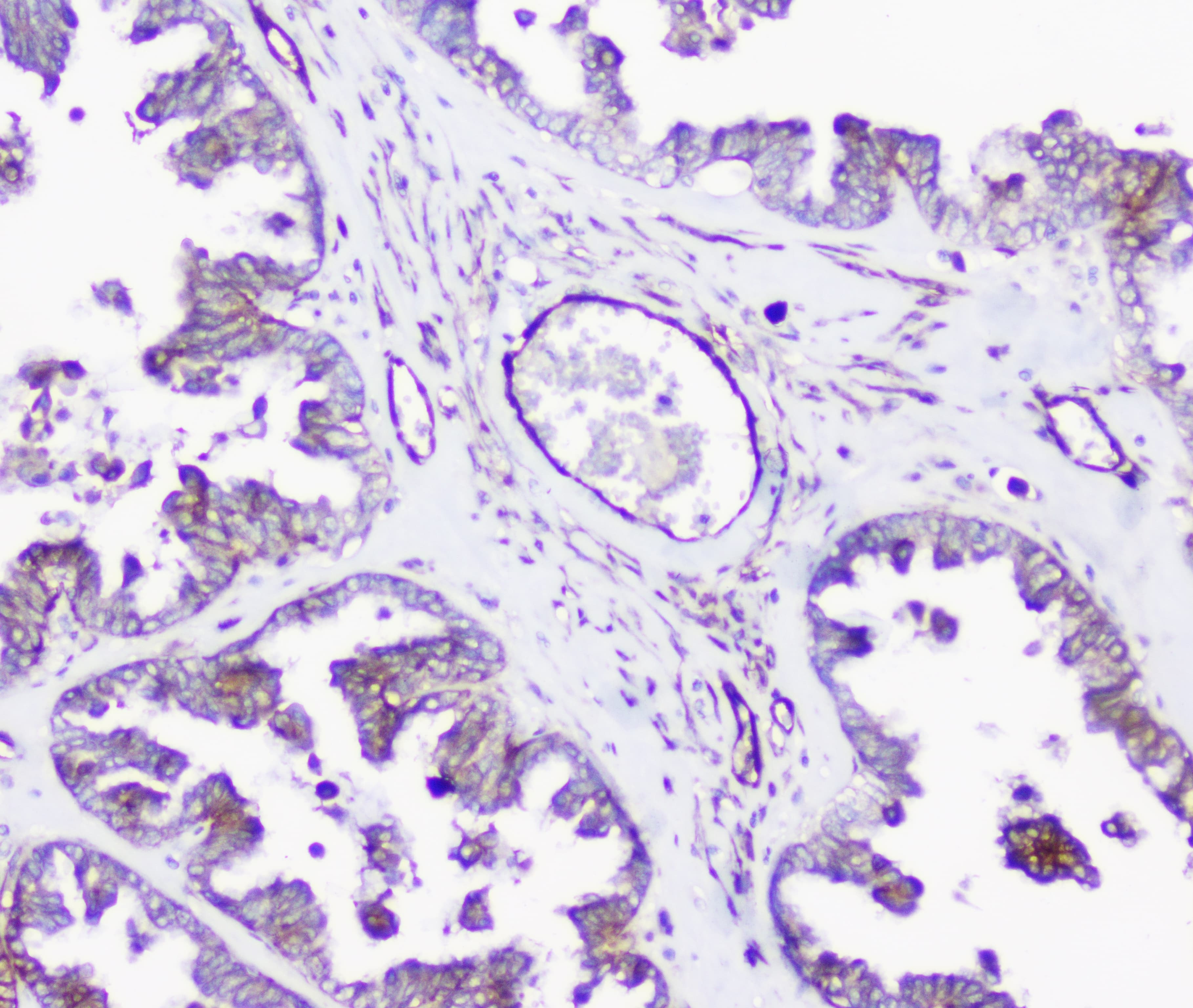 Polyclonal Rabbit anti-Human INPPL1 / SHIP2 Antibody (IHC, WB)