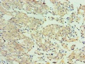 MTMR4 Antibody (aa570-820)