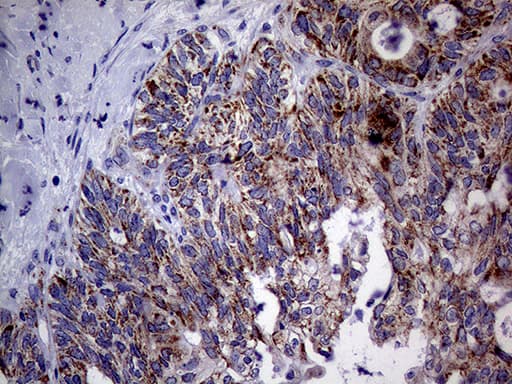 Monoclonal Mouse anti-Human MRPL15 Antibody (clone OTI10B10, aa28-296, IHC, WB)