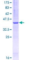 Human PLOD / PLOD1 Protein (Recombinant GST, N-terminus)