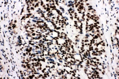 Polyclonal Rabbit anti-Human XRCC5 / Ku80 Antibody (aa648-662, IHC, WB)