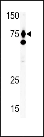 PathPlus™ Polyclonal Rabbit anti-Human HGF / Hepatocyte Growth Factor Antibody (aa521-554, IHC, WB)