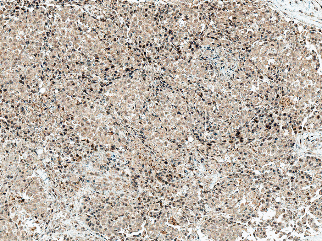 CREBBP / CREB Binding Protein Antibody (PerCP)