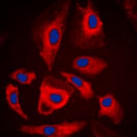 MARK1+2+3+4 Antibody (Internal)