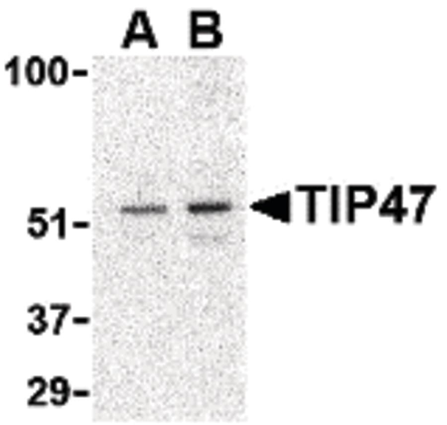 Polyclonal Rabbit anti-Human PLIN3 / M6PRBP1 / TIP47 Antibody (IHC, IF, WB)