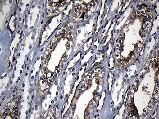 RRM2 Antibody (clone OTI3D3)