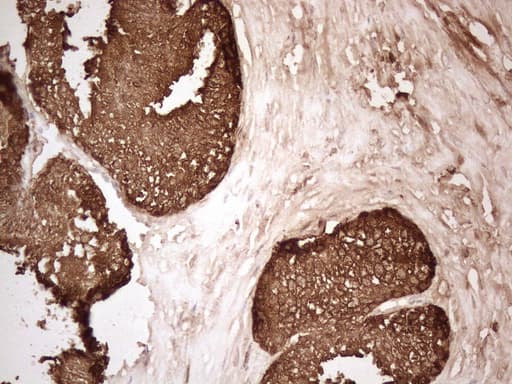 KLK3 / PSA Antibody (aa25-261, clone OTI2C9, Carrier-free)