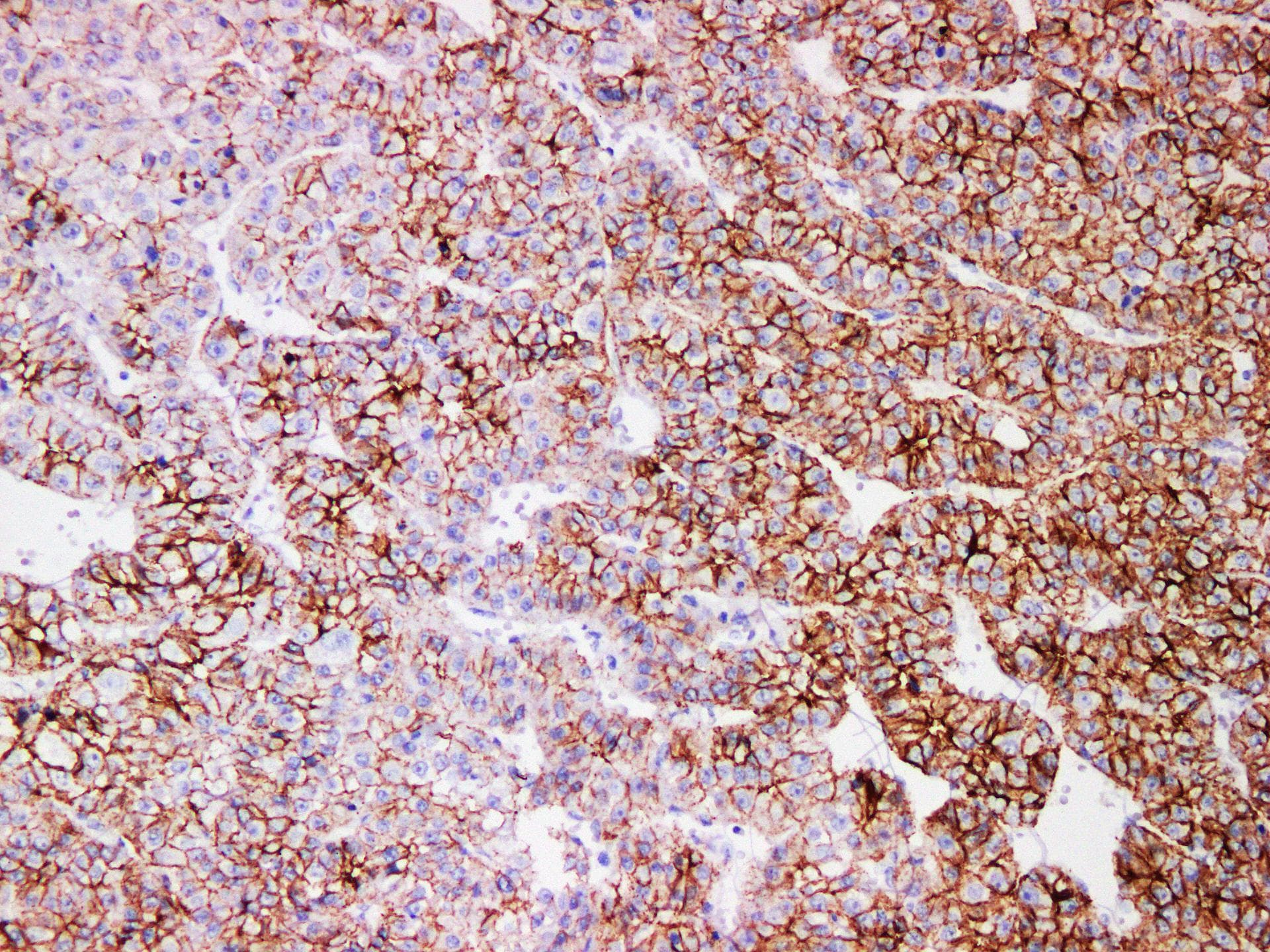 Cadherin Antibody