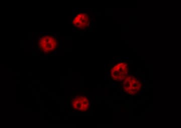 CSRP1 Antibody