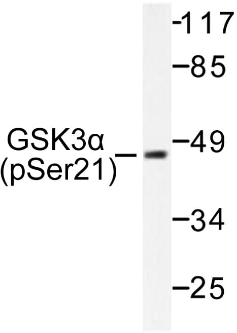 Polyclonal Rabbit anti-Human GSK3A / GSK3 Alpha Antibody (phospho-Ser21, IHC, WB)
