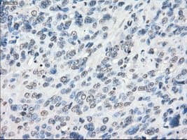 Monoclonal Mouse anti-Human CYPOR / POR Antibody (clone OTI1B11, IHC, IF, WB)