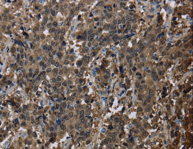 GSTA3 Antibody