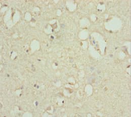 ACSL6 Antibody