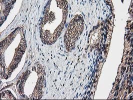 DSTN / Destrin Antibody (clone OTI1C5, Carrier-free)