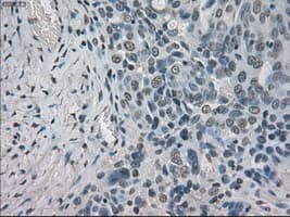 Monoclonal Mouse anti-Human BUB1B / BubR1 Antibody (clone OTI15E11, IHC, IF, WB)