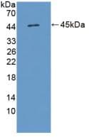Human IL17D Protein (Recombinant His-GST, N-terminus)