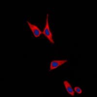 PathPlus™ CDH1 / E Cadherin Antibody (C-Terminus)