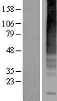 TACR1 / NK1R Protein (Over-Expression Lysate Myc-DDK (Flag))