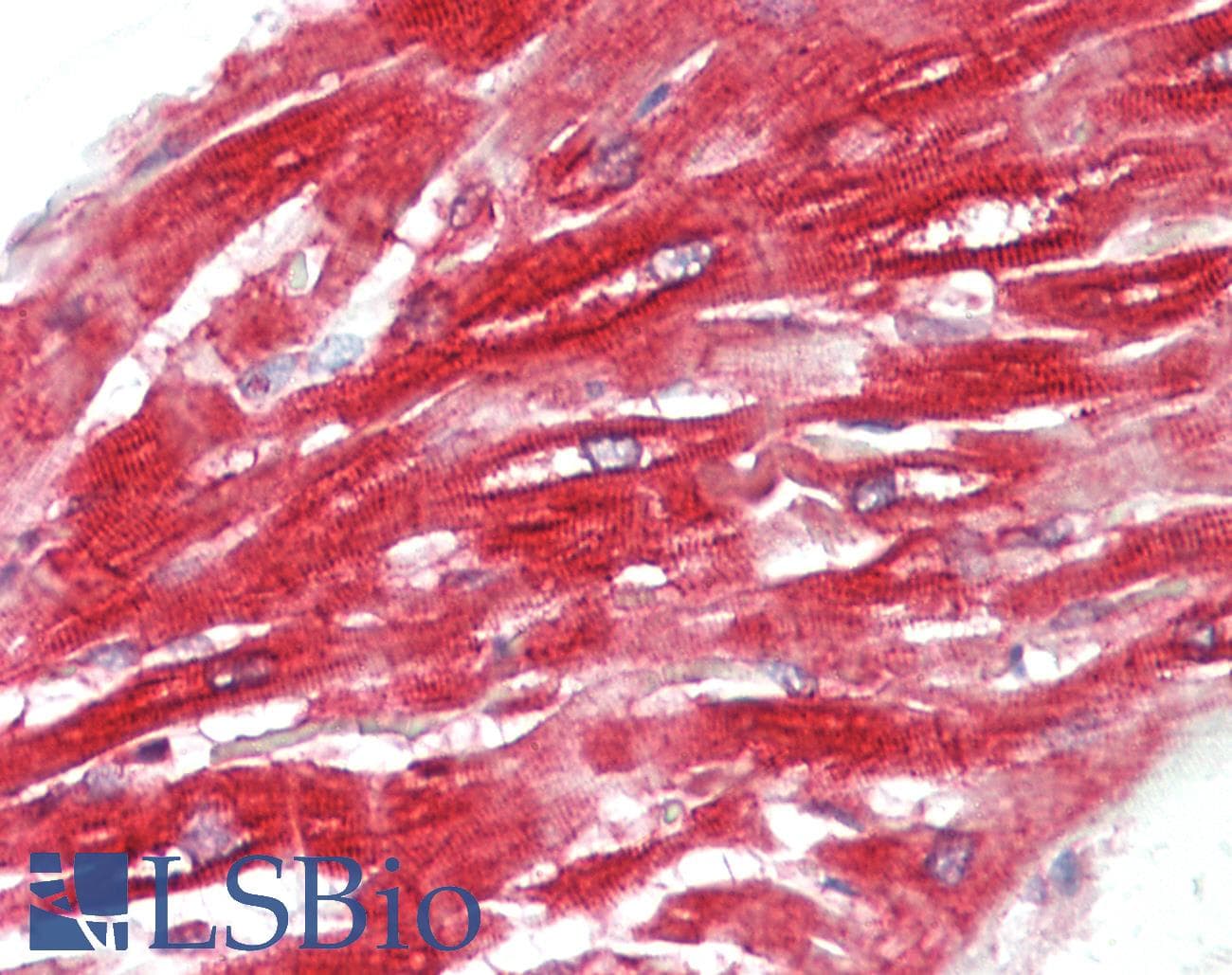 NEU1 / NEU Antibody (aa172-221)