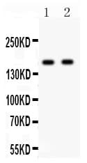 GRIN2A / NMDAR2A / NR2A Antibody (aa958-1300)
