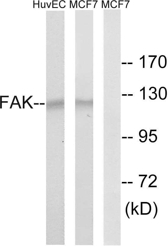 Polyclonal Rabbit anti-Human FAK / Focal Adhesion Kinase Antibody (aa809-858, IHC, WB)