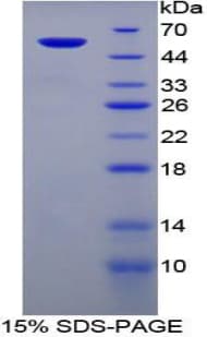 Mouse ABCB1 / MDR1 / P Glycoprotein (Recombinant His-GST)