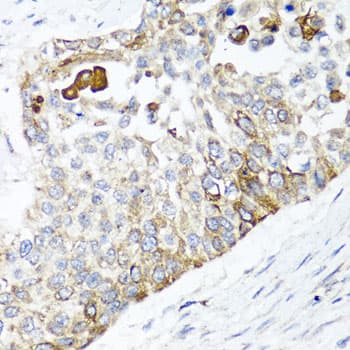 Polyclonal Rabbit anti-Human PPOX Antibody (IHC, IF, WB)
