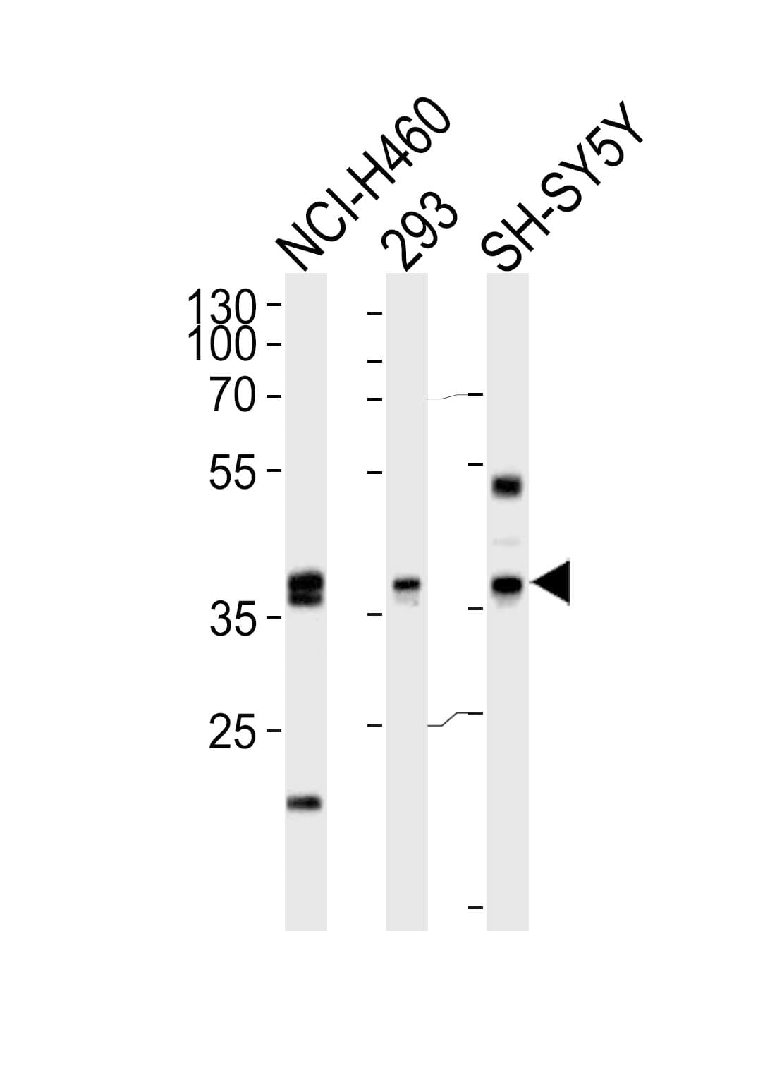 IHC-plus™ Polyclonal Rabbit anti-Human EN1 / Engrailed Antibody (aa1-30, IHC, IF, WB)