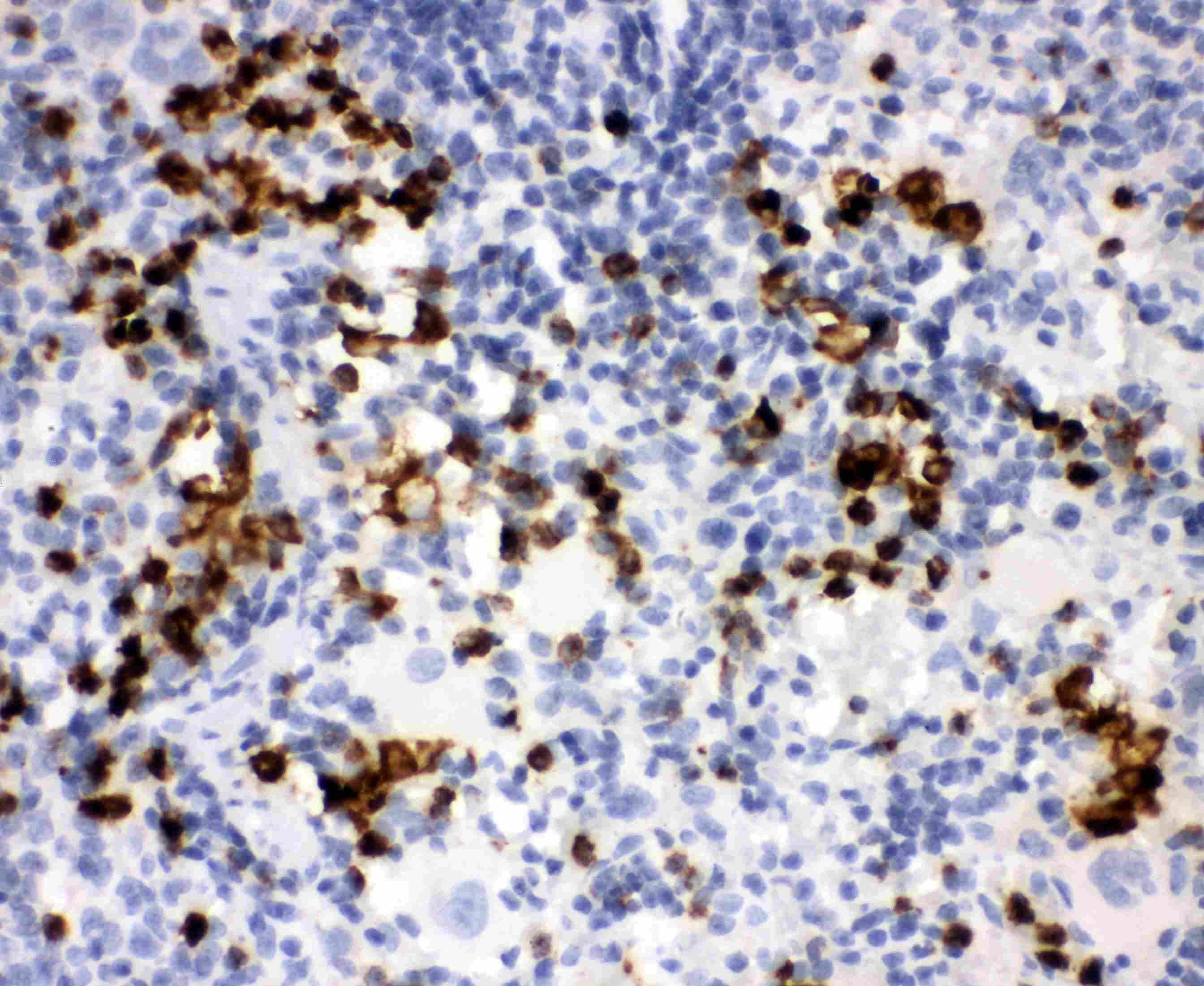 Polyclonal Rabbit anti-Human MPO / Myeloperoxidase Antibody (IHC, WB)