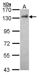 Polyclonal Rabbit anti-Human DDB1 Antibody (aa749-1140, IHC, WB)