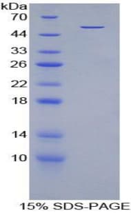 Mouse DIO3 Protein (Recombinant His, N-Terminal)