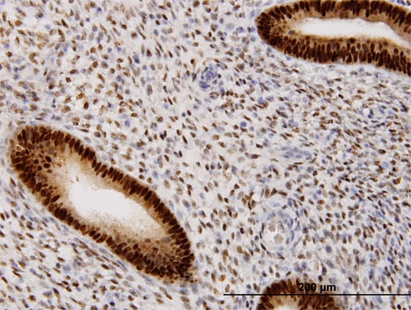 Monoclonal Mouse anti-Human PR / Progesterone Receptor Antibody (clone 2C2, IHC, IF, WB)
