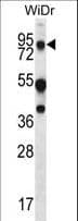 IHC-plus™ MUC20 Antibody (aa654-684)