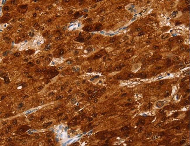 SULT2A1 / Sulfotransferase 2A1 Antibody