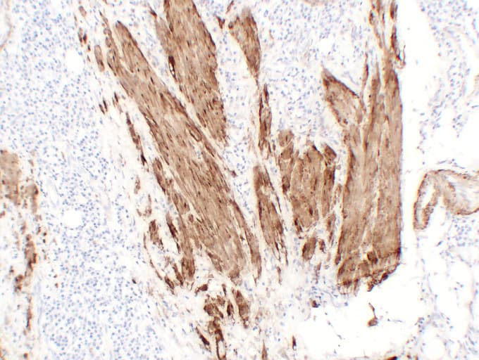 CNN1 / Calponin Antibody (clone ABT-CALP)
