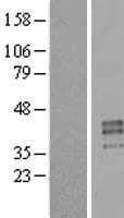 PRSS21 / Testisin Protein (Over-Expression Lysate Myc-DDK (Flag))