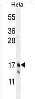 IHC-plus™ CLDN7 / Claudin 7 Antibody (aa172-201)