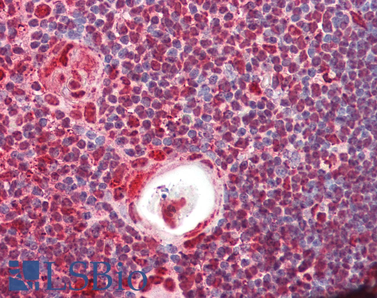 PathPlus™ HNRNPK / hnRNP K Antibody (aa1-50)