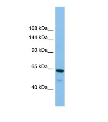 GRIK2 / GLUR6 Antibody (aa478-527)
