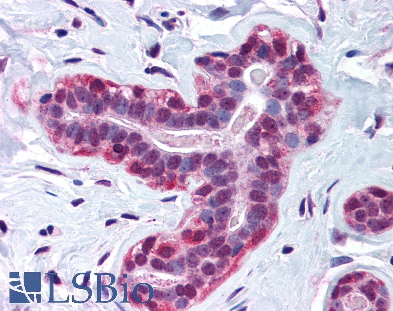 Polyclonal Rabbit anti-Human WRNIP1 / WHIP Antibody (aa67-116, IHC, WB)